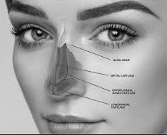 Nasal Surgery